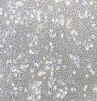 143B 人骨肉瘤细胞(STR鉴定）